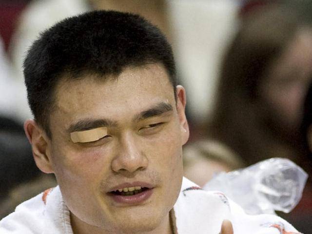 NBA眼珠子被打出来是谁？那些年赛场上的恐怖瞬间，真相其实没那么简单